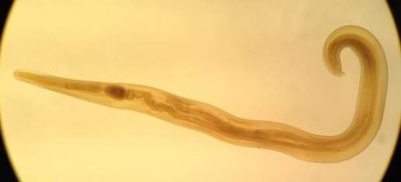 Lombriz intestinal