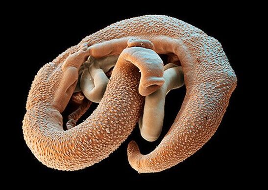 Esquistosoma