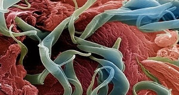 Gusanos en el cuerpo humano
