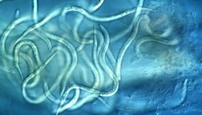 ¿Cómo se ven los parásitos nematodos en el cuerpo humano